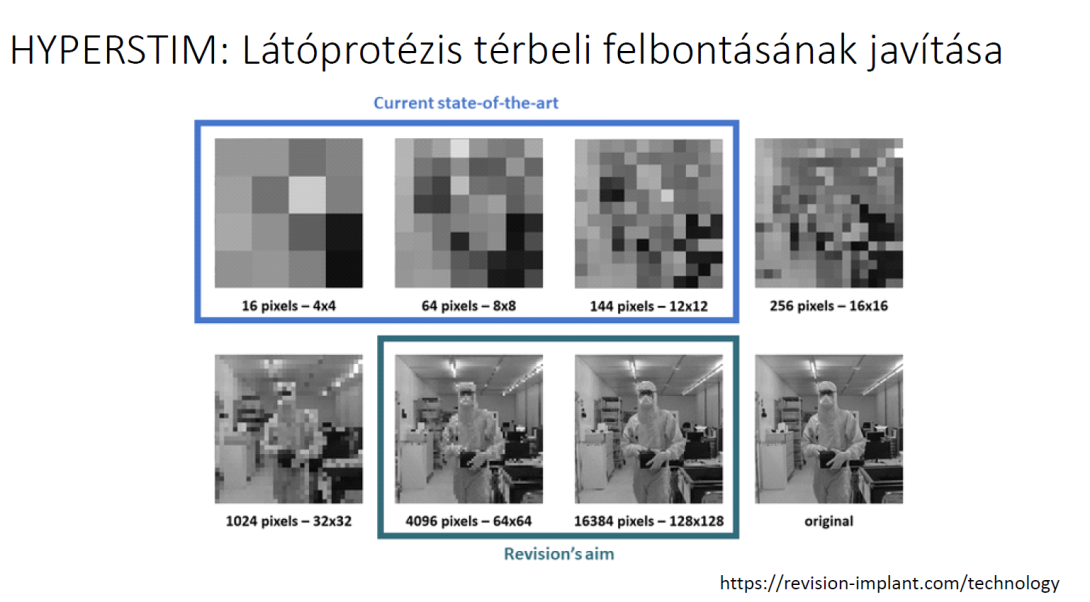 Látóprotézis térbeli felbontásának javítása ábrák